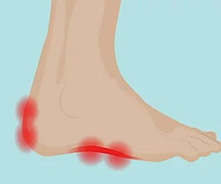 Neuropathy & Nerve Damage? Do This Immediately (Watch)