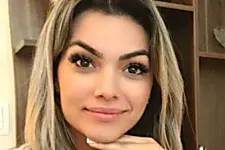 Famosa cantora revela misterioso clareador dental e vira febre no Brasil