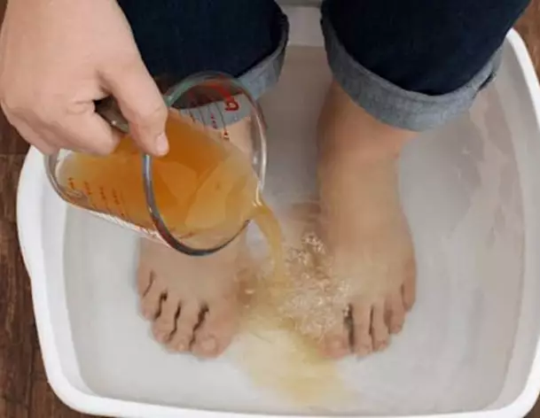 Try This Tonight Could Make Your Fungus Disappear (Watch)