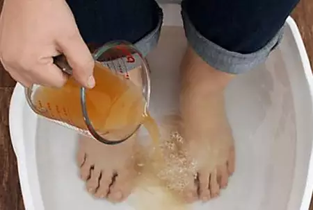This Woman 'Treat' Her Nail Fungus in 10 Minutes, Watch How