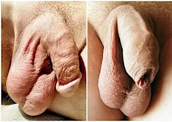 Penis Penis