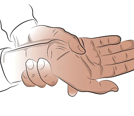 Tratamientos para la artritis reumatoide que podrían funcionar Tratamientos para la artritis reumatoide que podrían funcionar