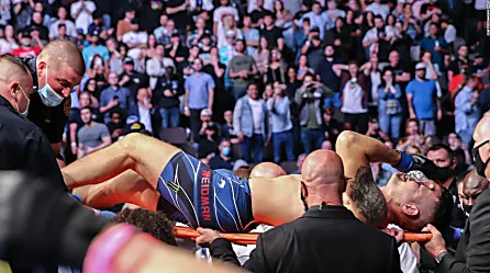 UFC: así luce la pierna de Chris Weidman tras su espeluznante lesión