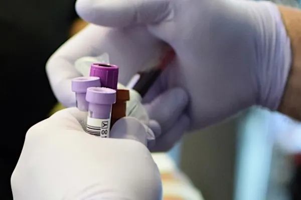 Investigators Coalesce Around Leading ctDNA Technologies, but Platform Diversity Persists