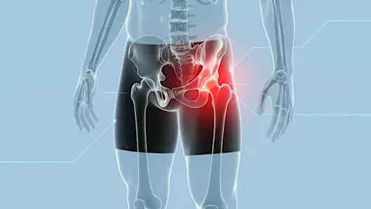 Hip Pain Is Not From Sitting Too Long. Meet The Real Enemy