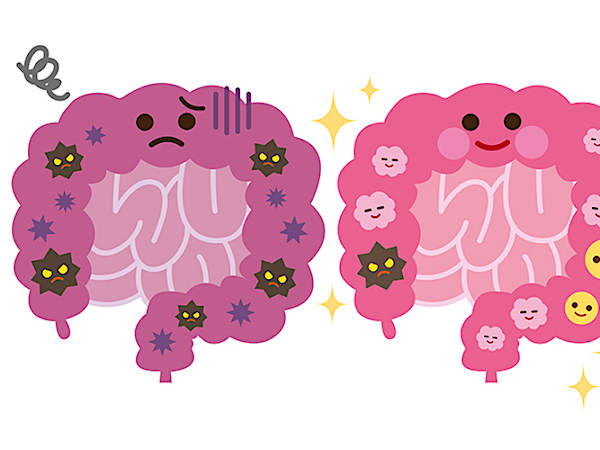 汚れた大腸を左右するのは乳酸菌よりもアレが重要