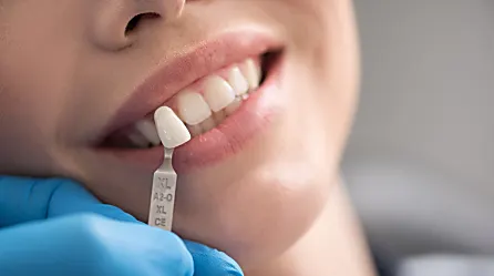 Dental Implants For Seniors Are Paid By Medicare in Caracas. (See How)