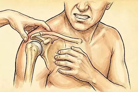 Expert Doctor: Anyone who suffers from neck and shoulder pain must read this!