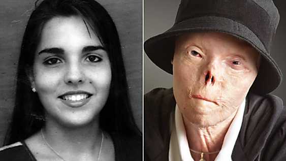 Jacqui Saburido, who became the face of an anti-drunk driving campaign, has died