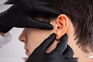 Severe Ringing in Ears is Being Linked To a Common Item. Cut It Out Now