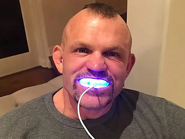 U.S. Dentist: The Secret to Getting a Million Dollar Smile