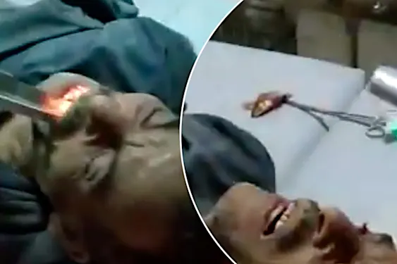 Οι γιατροί αφαιρούν ζωντανά ψάρια από τον λαιμό του ανθρώπου στην Αίγυπτο Οι γιατροί αφαιρούν ζωντανά ψάρια από τον λαιμό του ανθρώπου στην Αίγυπτο