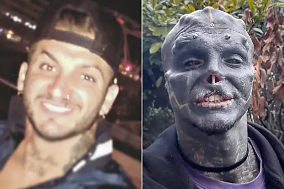 Man turns himself into ‘black alien’ by removing nose, top lip