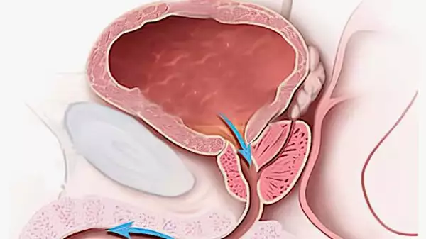 Προστάτη: ειδικός καλεί τους Έλληνες να το κάνουν κάθε πρωί