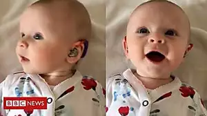 Moment baby girl's new hearing aids are turned on