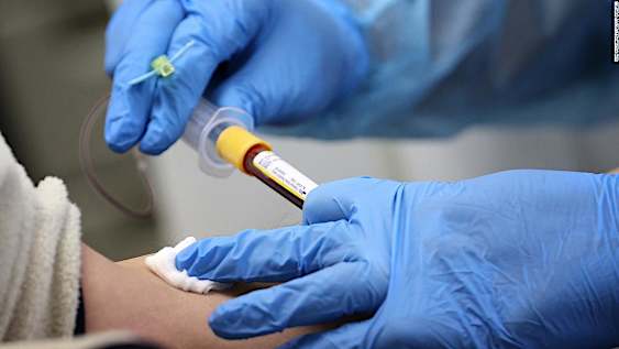 Blood type could be linked to Covid-19 risk and severity, new research suggests