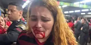 Biomédica denuncia agressão com cassetete por segurança do MetrôRio após jogo do Flamengo