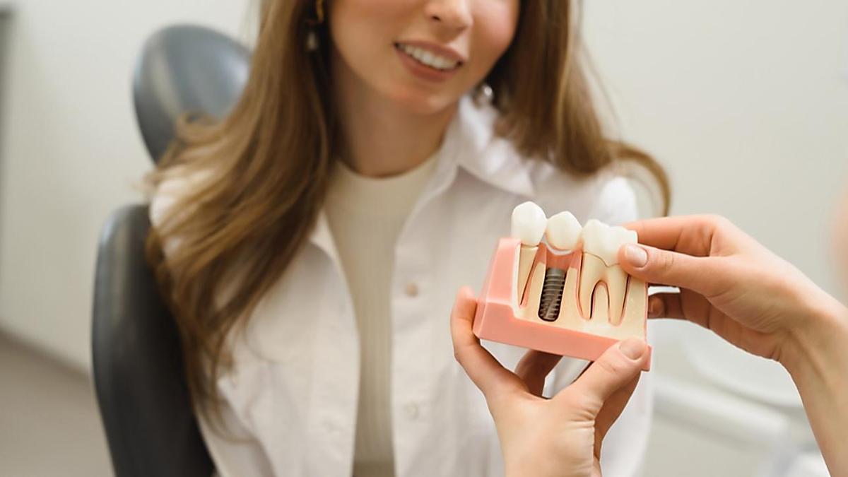 Brampton: Here Is What Full Mouth Dental Implants Should Cost You in 2022