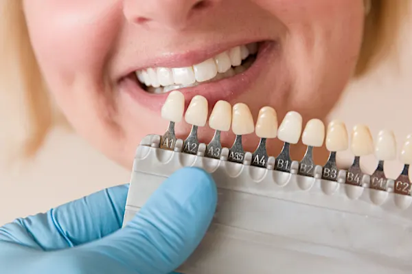 Here Is What Full Mouth Dental Implants Might Cost You in Dubai