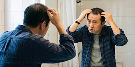 【世界初】頭皮に刺すスカルプケアが男性の救世主と話題に