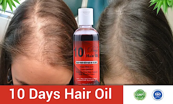 Handmade Oil in Kerala to Grow Hair and Prevent Hair Loss