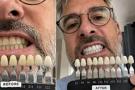 We've tested 27 popular teeth whitening products: Here are the 5 winners