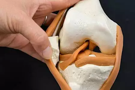 This Is The Wοrst Enemy Of Arthritis