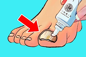 「一晩で？」爪の中まで殺菌して爪まわりをキレイに