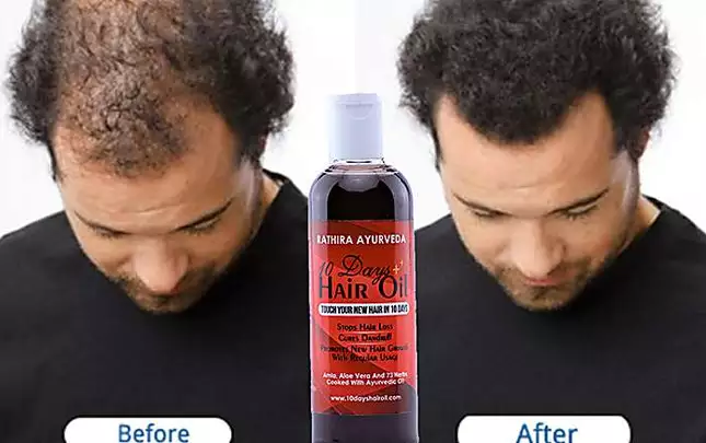Don't Worry about Hair Loss? Try The Ayurvedic Hair Oil. Made in Kerala.