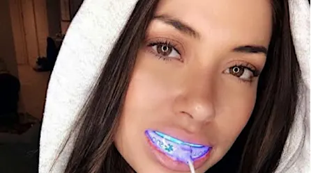 The Modern-Day Teeth Whitening Solution Celebrities Use