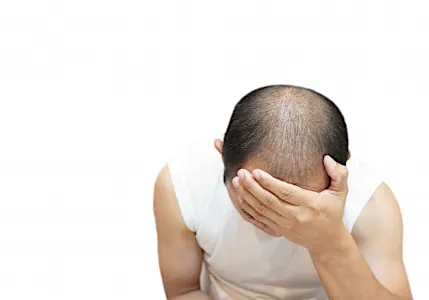 Anvisa substitui Minoxidil por uma nova fórmula 8x mais anti-calvície