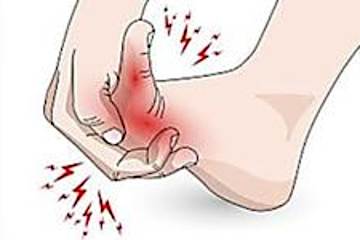 Neuropathy & Nerve Damage? Do This Now.