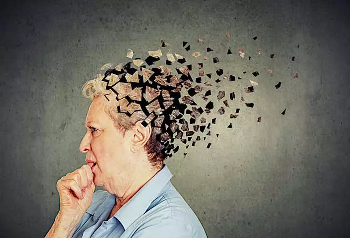 Cerveau d'Einstein : les résultats de l'analyse