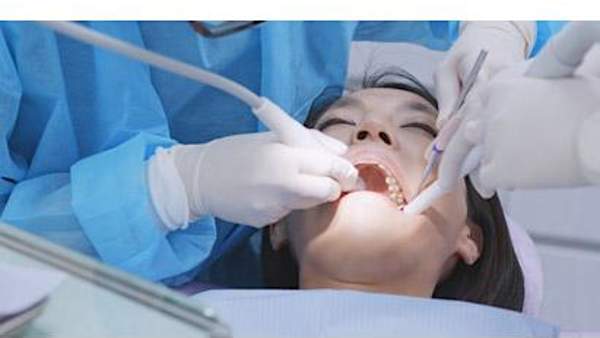 Bagaimana Sih Proses Pembersihan Karang Gigi? Yuk, Kenali Lebih Jauh Bagaimana Sih Proses Pembersihan Karang Gigi? Yuk, Kenali Lebih Jauh