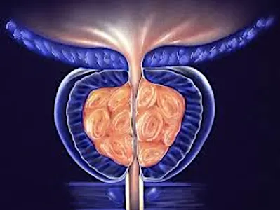 Urologist: Men With An Enlarged Prostate Do Not Know About This Simple Solution