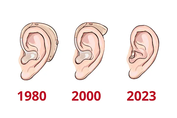 Cercasi 250 persone per testare un apparecchio acustico invisibile