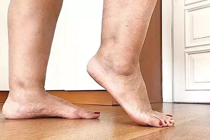 Doctor: This 10-Second Morning Ritual Helps Drain Swollen Legs (Watch Video) Doctor: This 10-Second Morning Ritual Helps Drain Swollen Legs (Watch Video)