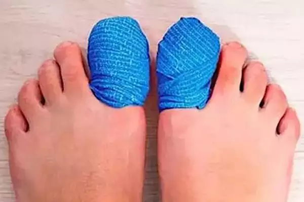 Κορυφαίος Ποδίατρος στην Ελλάδα: Αν έχετε μύκητα στα νύχια των ποδιών σας, δοκιμάστε αυτό απόψε (είναι ιδιοφυές)