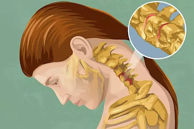 Un simple cambio en tu cama podría reducir los zumbidos en los oídos