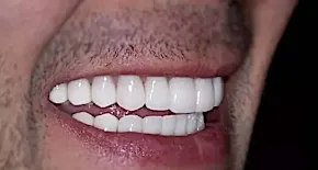 Dentist: Add This To Your Toothpaste To Help Regrow Gums in a Few Days