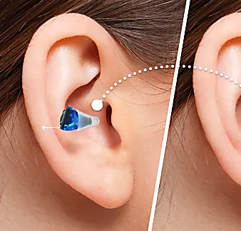 These German Hearing Aids are Crushing the Market