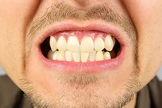 Diese einfache Methode kann das Zahnfleisch in wenigen Tagen nachwachsen lassen.