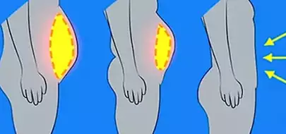 Graisse du ventre ? Le secret des Coréens pour rester minces toute leur vie