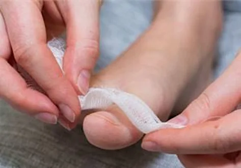 Simple Way To Reduce Toenail Fungus? (Watch) Simple Way To Reduce Toenail Fungus? (Watch)