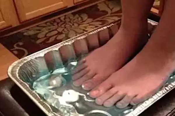 Ο γιατρός δεν μπορεί να εξηγήσει, αλλά αυτό μπορεί να κάνει τον μύκητα των νυχιών να εξαφανιστεί