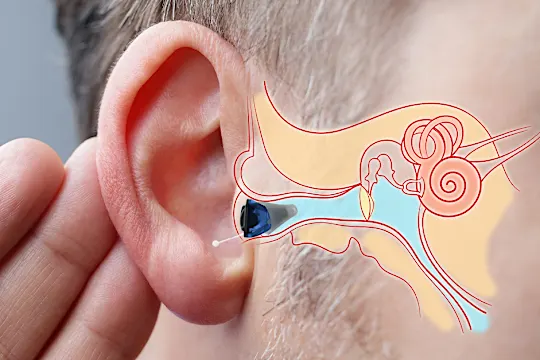 The cost of hearing aids in Ahmedabad might surprise you The cost of hearing aids in Ahmedabad might surprise you