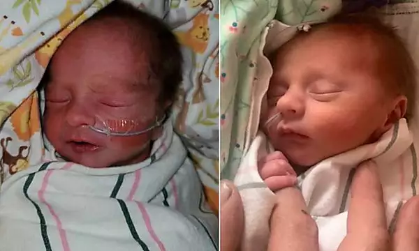 These twins were born in different decades