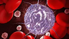 Understanding stem cell transplants for blood cancers