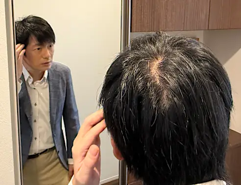 「頭皮が透けて見えたら…」バスクリンが快挙！有効成分生薬100%の育毛剤を開発