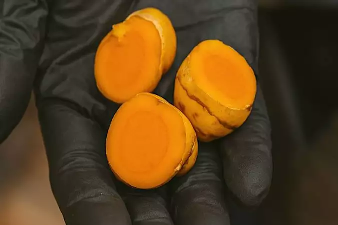 Ο ορκισμένος εχθρός της προστατίτιδας. Διαβάστε εδώ. Ο ορκισμένος εχθρός της προστατίτιδας. Διαβάστε εδώ.